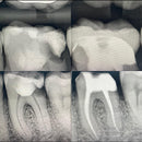 Endo-Resto with Dr Daniel Flynn & Dr Thomas Taha