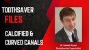 Toothsaver File with Model Tooth (Calcified & Curved Canals)