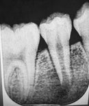 Endo with Daniel Flynn