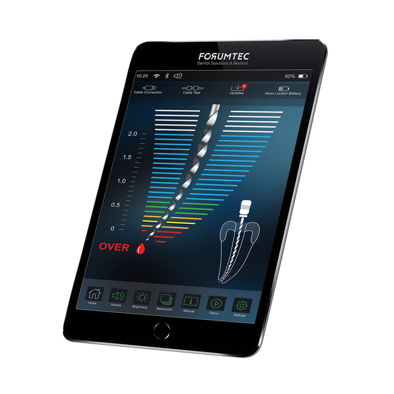 Wirelex apex locator