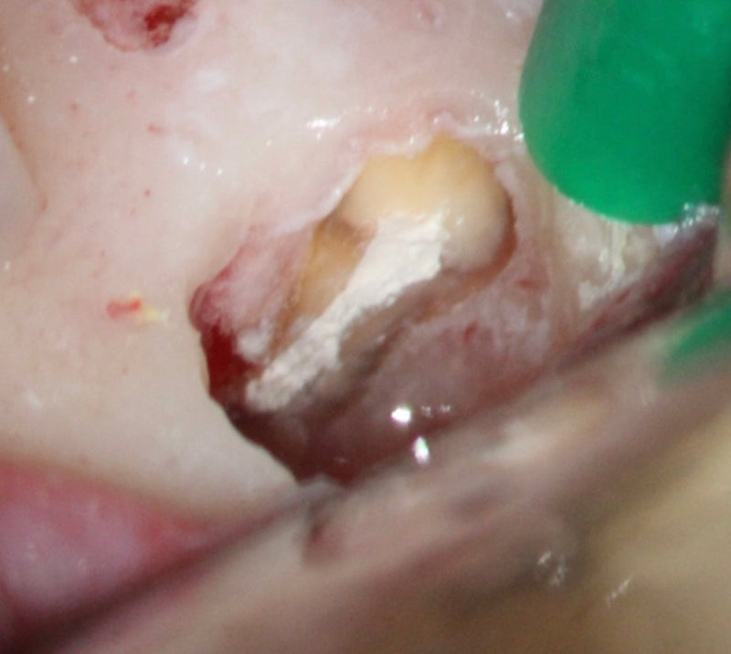 Toothsaver “The surgery course” Endo microsurgery course with Dr Paula Villa 6th/7th June 2025
