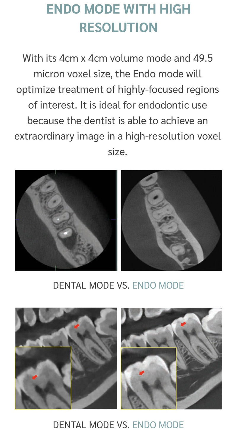 Green X- CBCT machine CONTACT US FOR PRICING