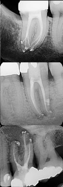 Endo of the future? With Dr Pirooz Zia