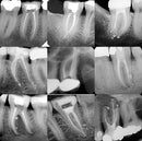 Endo of the future? With Dr Pirooz Zia