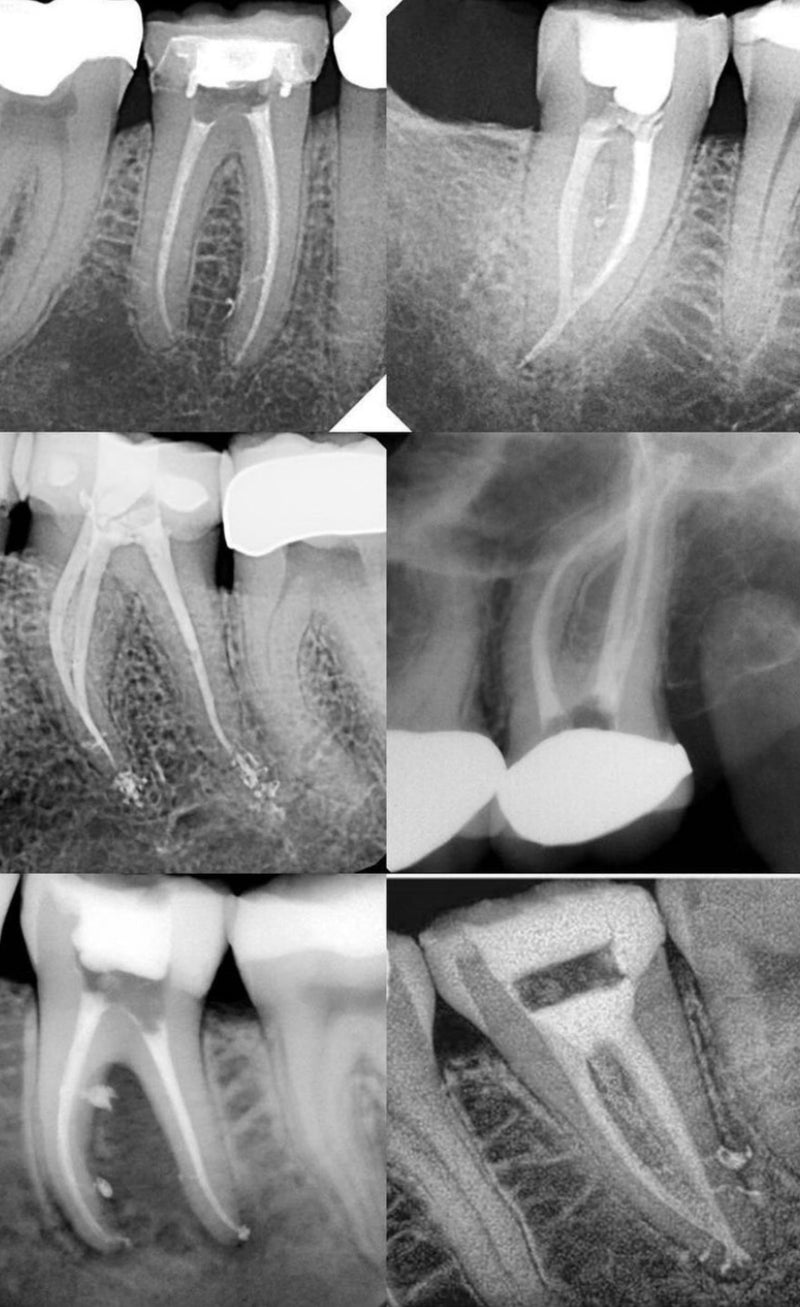 Endo of the future? With Dr Pirooz Zia