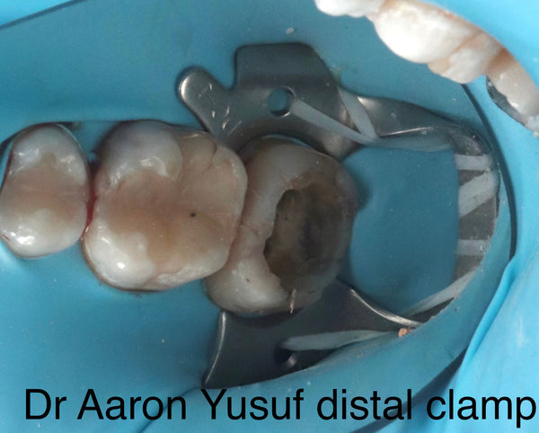Distal clamp